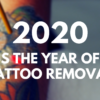 Laser Tattoo Removal Proves to be a Continuing Trend in 2020