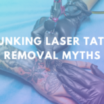 Debunking Laser Tattoo Removal Myths