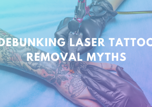 Debunking Laser Tattoo Removal Myths