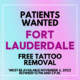 FT. Lauderdale Tattoo Removal