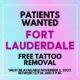 laser tattoo removal fort lauderdale new look laser college